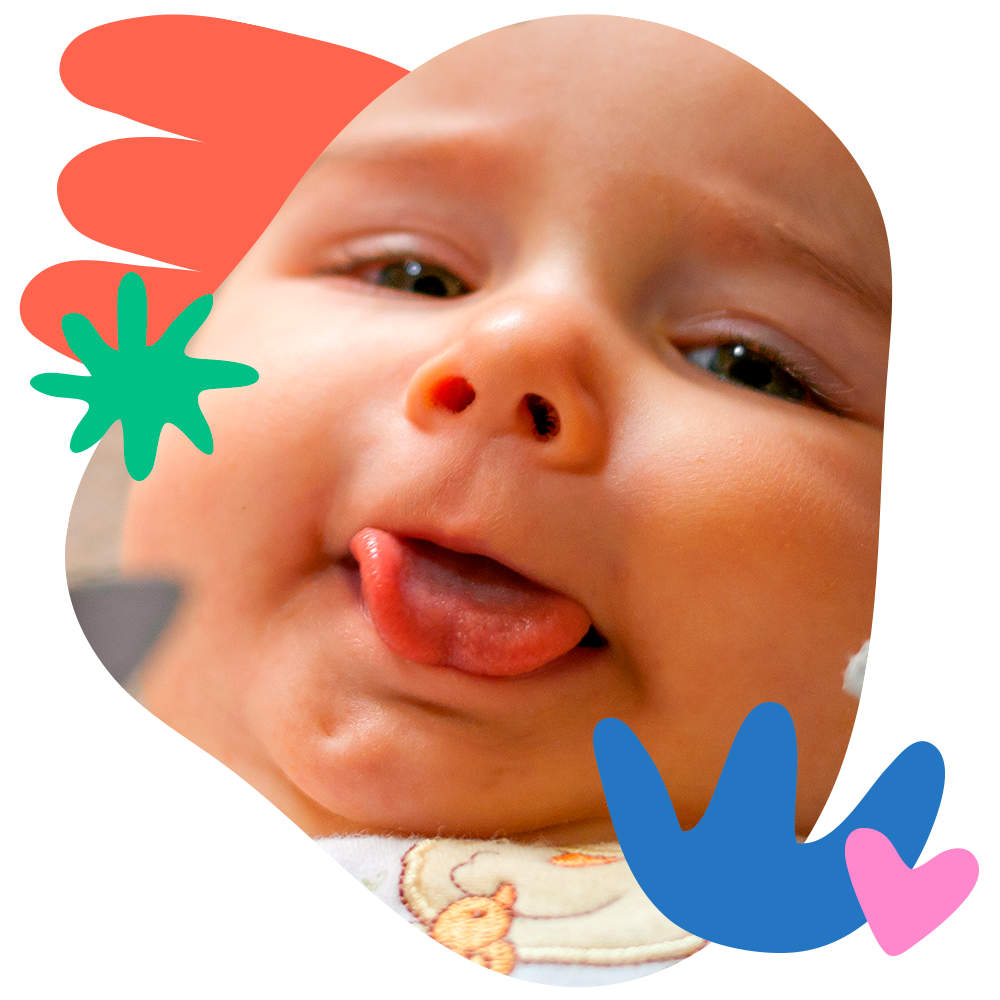 Tongue Tie Tongue Tie Institute