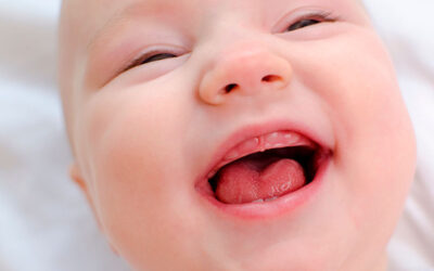 Tongue Tie in Infants: Common Myths and Misconceptions Debunked