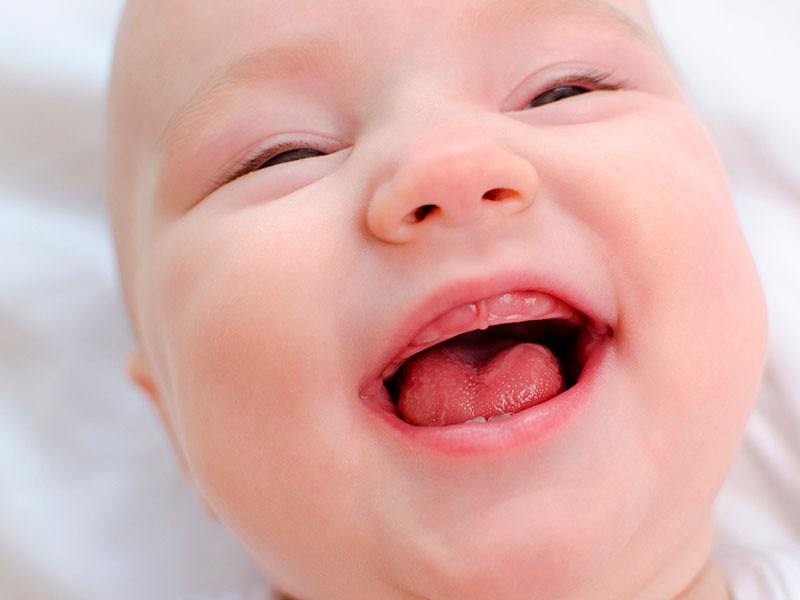 Tongue Tie in Infants: Common Myths and Misconceptions Debunked