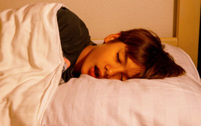 The Role of Tongue Tie in Sleep Disordered Breathing