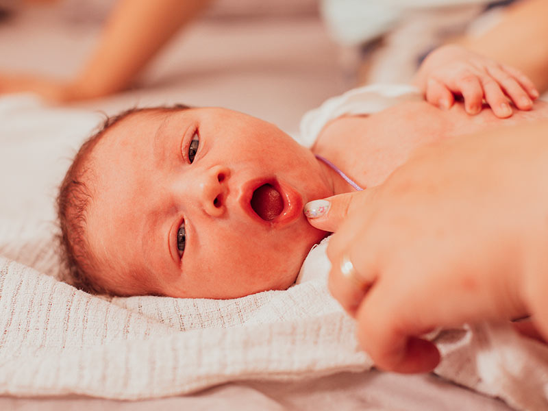 The Most Common Signs That Indicate Your Baby May Have Tongue Tie